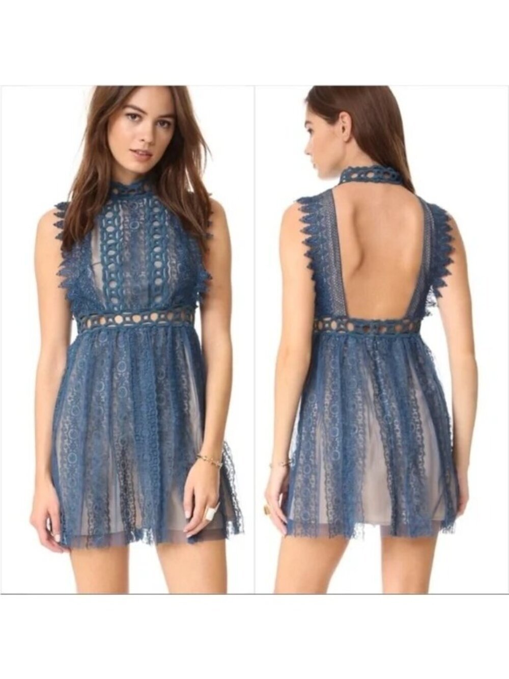 Free People Forever Lace Teal Open Back Mini Dress